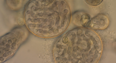 如何对抗水族箱蓝藻